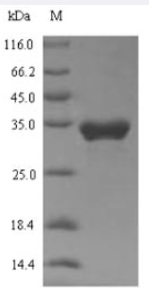 SDS-PAGE (TRPA1-345H).jpg